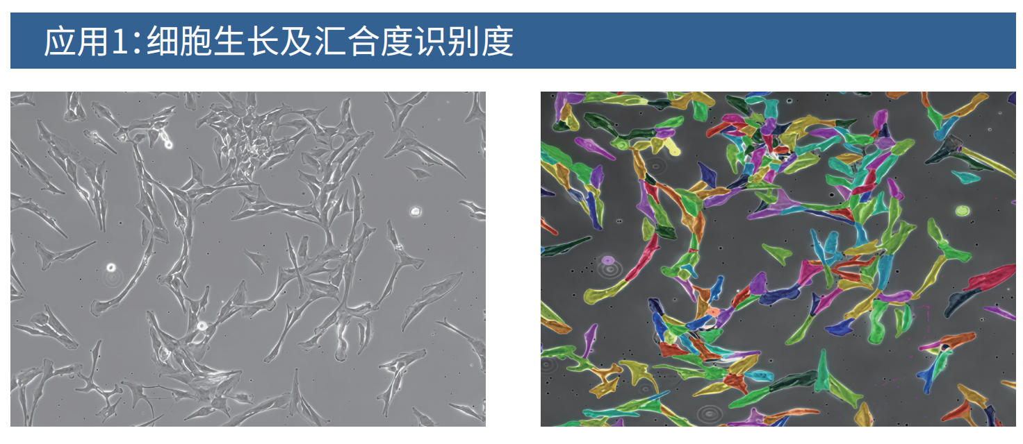 细胞生长及汇合度识别度.png