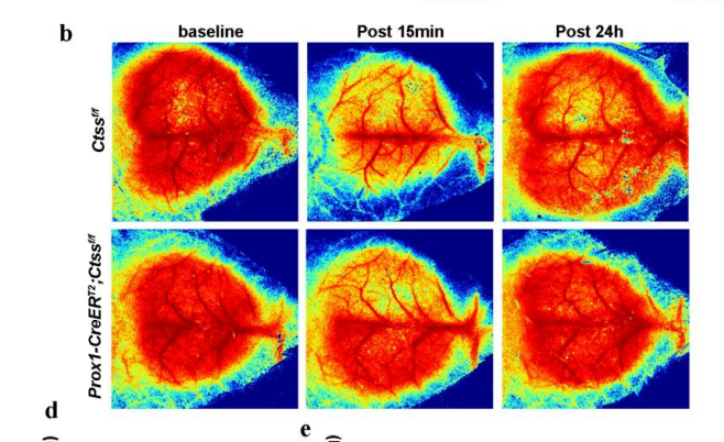 小鼠脑部血流图