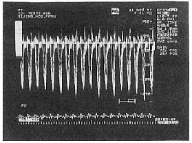 超声检测大鼠心脏结构与功能(图4)